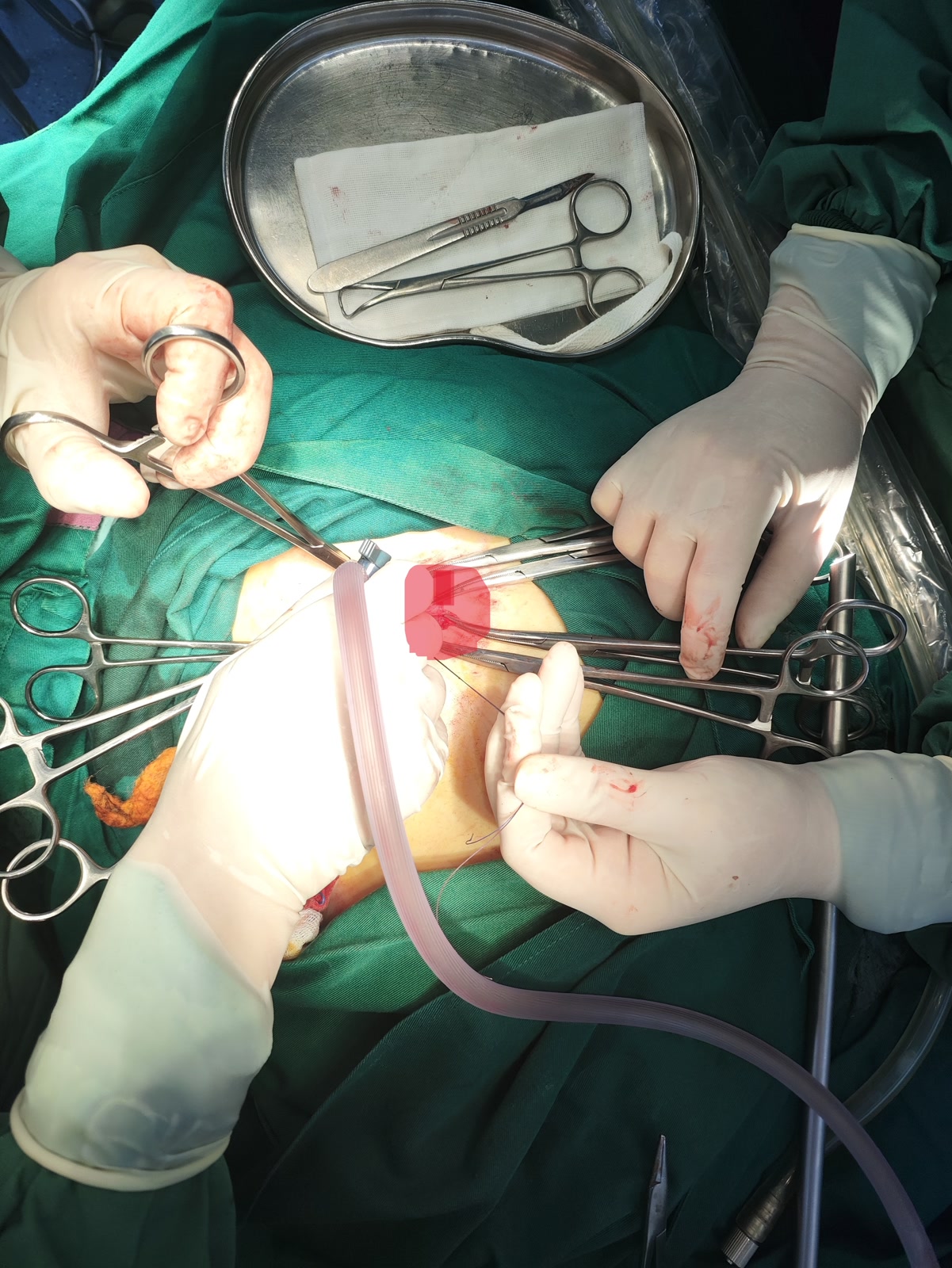 Orthopedic Surgery